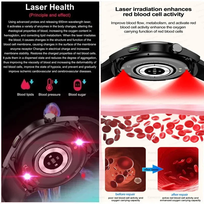 Laser Therapy Smartwatch – Blood Glucose & Uric Acid Monitor, Heart Rate Tracker, Waterproof